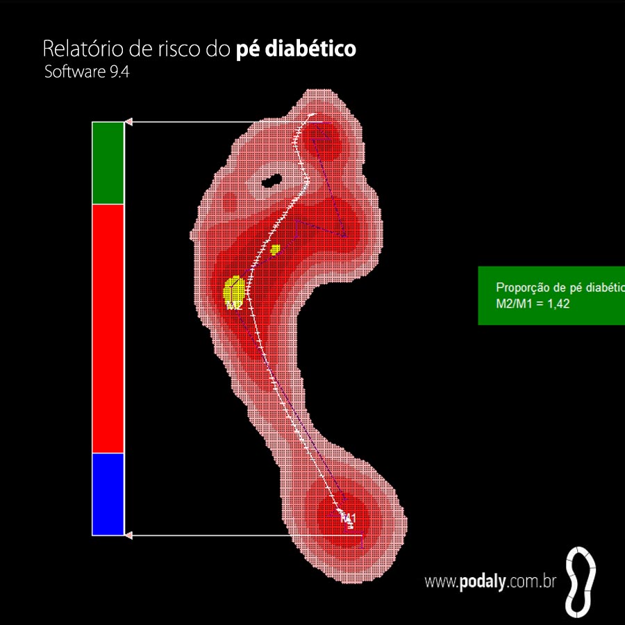 REPOSIÇÃO • SOFTWARE BAROPODOMETRO S.PLATE E T.PLATE • VERSÃO 9.4