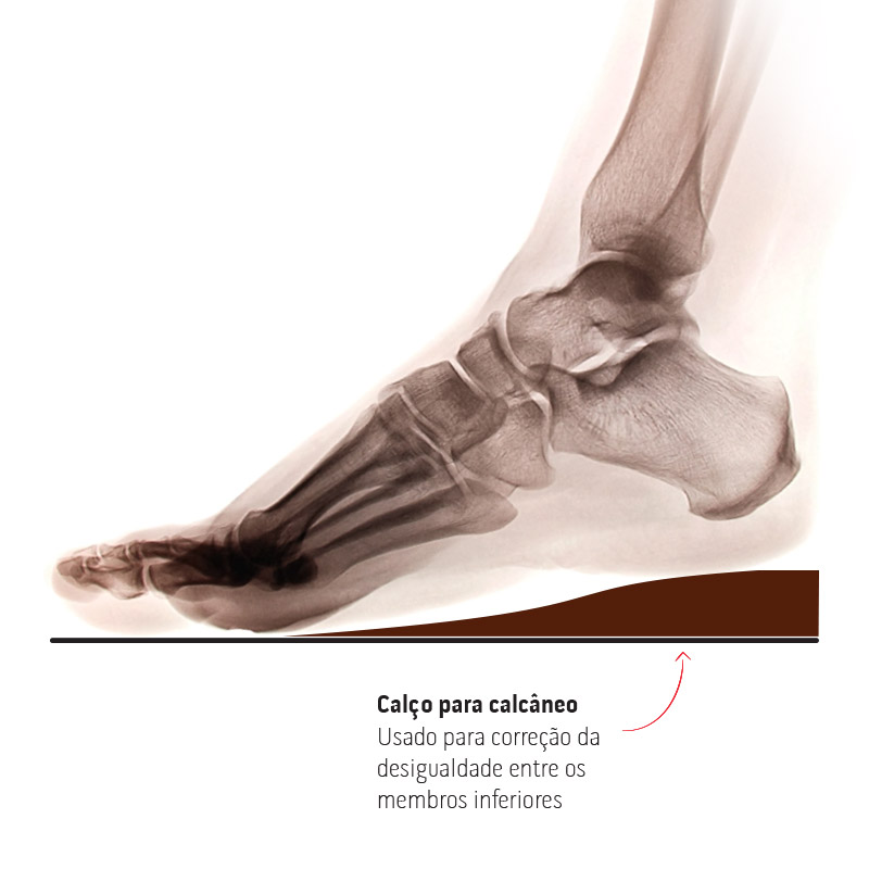 UNIDADE CALÇO ±11MM PONTA ESTOQUE